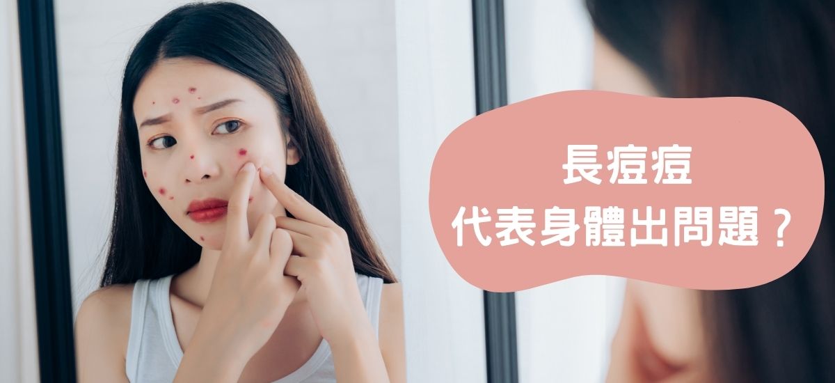 痘痘位置 了解臉頰額頭下巴長痘原因